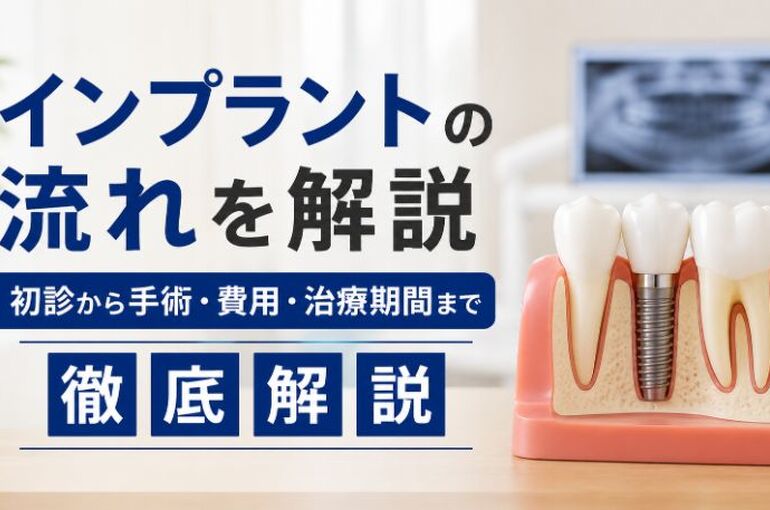 インプラント流れ
